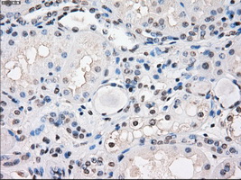 FRA-1 / FOSL1 Antibody - IHC of paraffin-embedded Kidney tissue using anti-FOSL1 mouse monoclonal antibody. (Dilution 1:50).