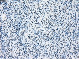 FRA-1 / FOSL1 Antibody - IHC of paraffin-embedded Ovary tissue using anti-FOSL1 mouse monoclonal antibody. (Dilution 1:50).