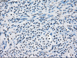 FRA-1 / FOSL1 Antibody - IHC of paraffin-embedded endometrium tissue using anti-FOSL1 mouse monoclonal antibody. (Dilution 1:50).