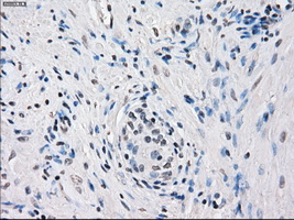 FRA-1 / FOSL1 Antibody - IHC of paraffin-embedded prostate tissue using anti-FOSL1 mouse monoclonal antibody. (Dilution 1:50).