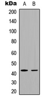 FRA-1 / FOSL1 Antibody - Western blot analysis of FOSL1 expression in HeLa (A); HepG2 (B) whole cell lysates.