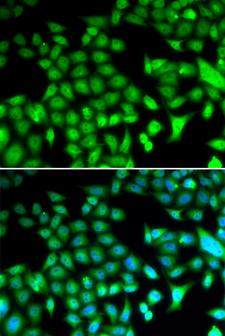 FRA-1 / FOSL1 Antibody - Immunofluorescence analysis of HeLa cell using FOSL1 antibody. Blue: DAPI for nuclear staining.