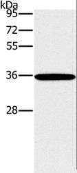 FRA-1 / FOSL1 Antibody - Western blot analysis of 231 cell, using FOSL1 Polyclonal Antibody at dilution of 1:615.