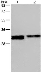 FRA-1 / FOSL1 Antibody - Western blot analysis of HeLa and Jurkat cell, using FOSL1 Polyclonal Antibody at dilution of 1:615.