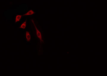 FRA-1 / FOSL1 Antibody - Staining HT29 cells by IF/ICC. The samples were fixed with PFA and permeabilized in 0.1% Triton X-100, then blocked in 10% serum for 45 min at 25°C. The primary antibody was diluted at 1:200 and incubated with the sample for 1 hour at 37°C. An Alexa Fluor 594 conjugated goat anti-rabbit IgG (H+L) antibody, diluted at 1/600, was used as secondary antibody.