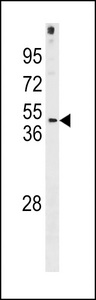 FRA10AC1 Antibody - FRA10AC1 Antibody western blot of NCI-H292 cell line lysates (35 ug/lane). The FRA10AC1 antibody detected the FRA10AC1 protein (arrow).