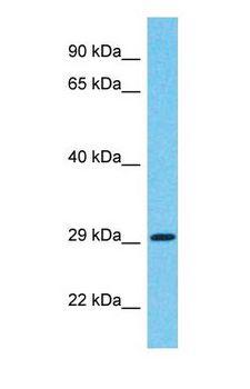 FRA10AC1 Antibody - Western blot of FRA10AC1 Antibody with human Fetal Lung lysate.  This image was taken for the unconjugated form of this product. Other forms have not been tested.
