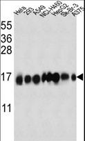 Fragilis / IFITM3 Antibody - IFITM3 Antibody western blot of HeLa,293,A549,NCI-H460,HepG2,Sk-Br-3,A375 cell line lysates (35 ug/lane). The IFITM3 antibody detected the IFITM3 protein (arrow).