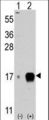 Fragilis / IFITM3 Antibody - Western blot of IFITM3 (arrow) using rabbit polyclonal IFITM3 Antibody. 293 cell lysates (2 ug/lane) either nontransfected (Lane 1) or transiently transfected with the IFITM3 gene (Lane 2) (Origene Technologies).