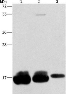 Fragilis / IFITM3 Antibody - Western blot analysis of HeLa, hepg2 and A375 cell, using IFITM3 Polyclonal Antibody at dilution of 1:500.