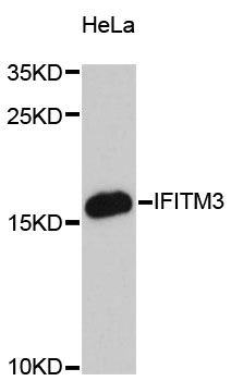 Fragilis / IFITM3 Antibody - Western blot analysis of extracts of HeLa cells, using IFITM3 antibody at 1:3000 dilution. The secondary antibody used was an HRP Goat Anti-Rabbit IgG (H+L) at 1:10000 dilution. Lysates were loaded 25ug per lane and 3% nonfat dry milk in TBST was used for blocking. An ECL Kit was used for detection and the exposure time was 90s.