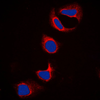Fragilis / IFITM3 Antibody - Immunofluorescent analysis of IFITM3 staining in HeLa cells. Formalin-fixed cells were permeabilized with 0.1% Triton X-100 in TBS for 5-10 minutes and blocked with 3% BSA-PBS for 30 minutes at room temperature. Cells were probed with the primary antibody in 3% BSA-PBS and incubated overnight at 4 C in a humidified chamber. Cells were washed with PBST and incubated with a DyLight 594-conjugated secondary antibody (red) in PBS at room temperature in the dark. DAPI was used to stain the cell nuclei (blue).