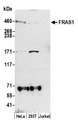 FRAS1 Antibody - Detection of human FRAS1 by western blot. Samples: Whole cell lysate (50 µg) from HeLa, HEK293T, and Jurkat cells prepared using NETN lysis buffer. Antibody: Affinity purified rabbit anti-FRAS1 antibody used for WB at 1:1000. Detection: Chemiluminescence with an exposure time of 3 minutes.