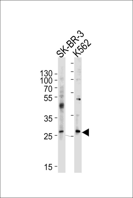 FRAT1 Antibody - Western blot of lysates from SK-BR-3, K562 cell line (from left to right), using FRAT1 Antibody. Antibody was diluted at 1:1000 at each lane. A goat anti-rabbit IgG H&L (HRP) at 1:5000 dilution was used as the secondary antibody. Lysates at 35ug per lane.