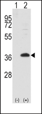 FRAT1 Antibody - Western blot of FRAT1 (arrow) using rabbit polyclonal FRAT1 Antibody. 293 cell lysates (2 ug/lane) either nontransfected (Lane 1) or transiently transfected with the FRAT1 gene (Lane 2) (Origene Technologies).