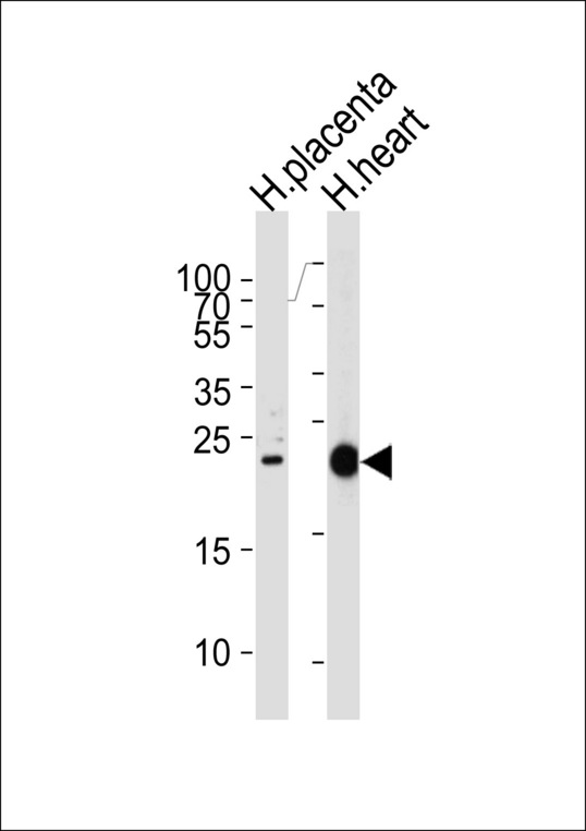 FRAT2 Antibody - Western blot of lysates from human placenta and heart tissue lysates (from left to right), using FRAT2 Antibody. Antibody was diluted at 1:1000 at each lane. A goat anti-rabbit IgG H&L (HRP) at 1:5000 dilution was used as the secondary antibody. Lysates at 35ug per lane.