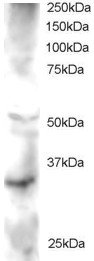 FRAT2 Antibody - Antibody staining (2 ug/ml) of Human Heart lysate (RIPA buffer, 30 ug total protein per lane). Primary incubated for 1 hour. Detected by Western blot of chemiluminescence.