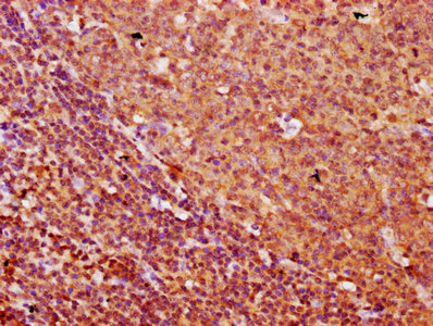 FREM1 Antibody - Immunohistochemistry Dilution at 1:500 and staining in paraffin-embedded human tonsil tissue performed on a Leica BondTM system. After dewaxing and hydration, antigen retrieval was mediated by high pressure in a citrate buffer (pH 6.0). Section was blocked with 10% normal Goat serum 30min at RT. Then primary antibody (1% BSA) was incubated at 4°C overnight. The primary is detected by a biotinylated Secondary antibody and visualized using an HRP conjugated SP system.