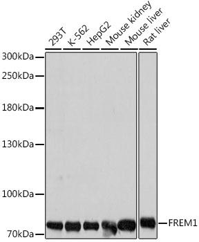 FREM1 Antibody - Western blot analysis of extracts of various cell lines using FREM1 Polyclonal Antibody at dilution of 1:1000.