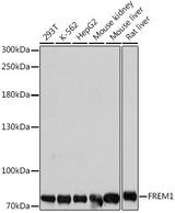 FREM1 Antibody - Western blot analysis of extracts of various cell lines using FREM1 Polyclonal Antibody at dilution of 1:1000.