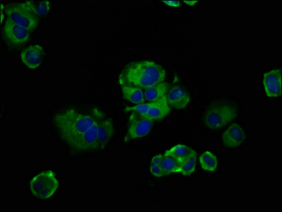 FREM2 Antibody - Immunofluorescence staining of MCF-7 cells at a dilution of 1:133, counter-stained with DAPI. The cells were fixed in 4% formaldehyde, permeabilized using 0.2% Triton X-100 and blocked in 10% normal Goat Serum. The cells were then incubated with the antibody overnight at 4 °C.The secondary antibody was Alexa Fluor 488-congugated AffiniPure Goat Anti-Rabbit IgG (H+L) .