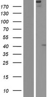 FREM2 Protein - Western validation with an anti-DDK antibody * L: Control HEK293 lysate R: Over-expression lysate