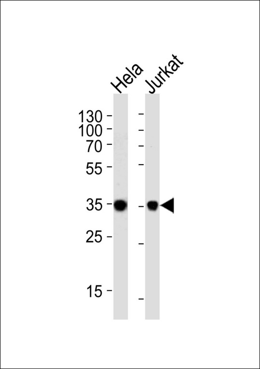FRG1 Antibody - Western blot of lysates from HeLa, Jurkat cell line (from left to right), using FRG1 Antibody. Antibody was diluted at 1:1000 at each lane. A goat anti-rabbit IgG H&L (HRP) at 1:5000 dilution was used as the secondary antibody. Lysates at 35ug per lane.