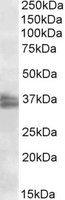 FRG1 Antibody - FRG1 antibody (2 ug/ml) staining of Jurkat nuclear lysate (35 ug protein/ml in RIPA buffer). Primary incubation was 1 hour. Detected by chemiluminescence.