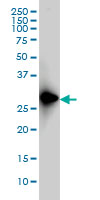 FRG1 Antibody - FRG1 monoclonal antibody (M01), clone 4A5 Western Blot analysis of FRG1 expression in HeLa NE.