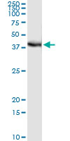 FRG1 Antibody - Immunoprecipitation of FRG1 transfected lysate using anti-FRG1 monoclonal antibody and Protein A Magnetic Bead, and immunoblotted with FRG1 rabbit polyclonal antibody.