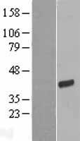 FRG1 Protein - Western validation with an anti-DDK antibody * L: Control HEK293 lysate R: Over-expression lysate