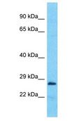 FRG2B Antibody - FRG2B antibody Western Blot of HeLa. Antibody dilution: 1 ug/ml.  This image was taken for the unconjugated form of this product. Other forms have not been tested.
