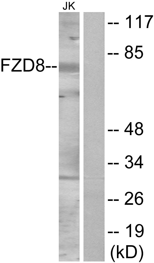 Frizzled 5+8 Antibody - Western blot analysis of lysates from Jurkat cells, using FZD8 Antibody. The lane on the right is blocked with the synthesized peptide.