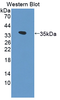 FRK Antibody - Western blot of FRK antibody.