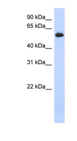 FRK Antibody - FRK antibody Western blot of Transfected 293T cell lysate. This image was taken for the unconjugated form of this product. Other forms have not been tested.