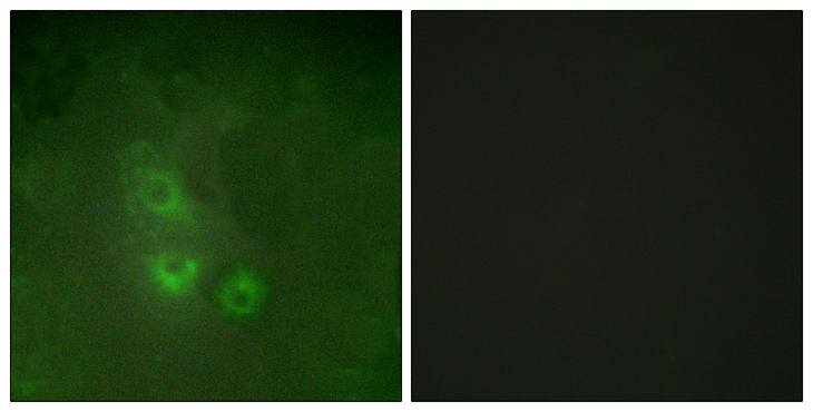 FRK Antibody - Immunofluorescence analysis of HUVEC cells, using FRK Antibody. The picture on the right is blocked with the synthesized peptide.