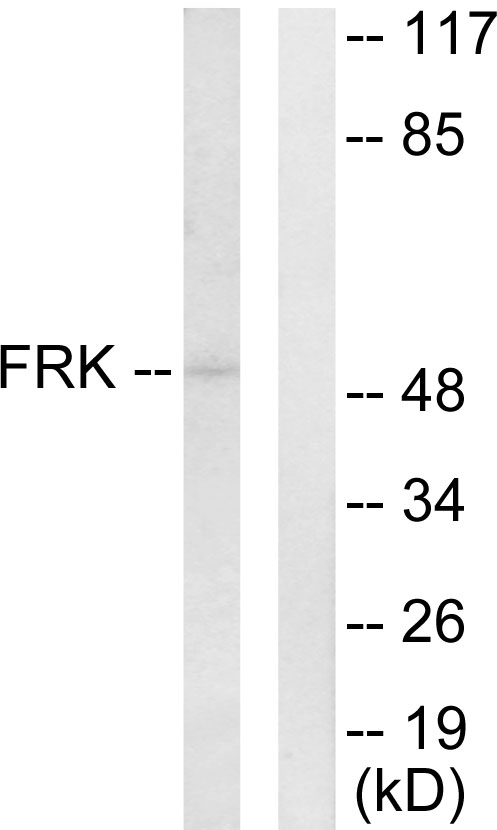 FRK Antibody - Western blot analysis of lysates from Jurkat cells, using FRK Antibody. The lane on the right is blocked with the synthesized peptide.
