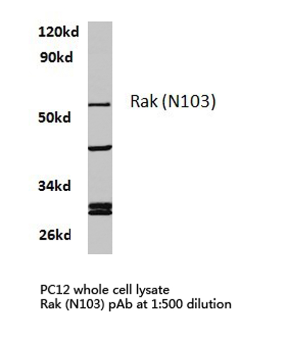 FRK Antibody - Western blot of Rak (N103) pAb in extracts from PC12 cells.