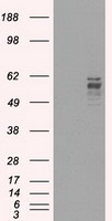 FRK Antibody - HEK293T cells were transfected with the pCMV6-ENTRY control (Left lane) or pCMV6-ENTRY FRK (Right lane) cDNA for 48 hrs and lysed. Equivalent amounts of cell lysates (5 ug per lane) were separated by SDS-PAGE and immunoblotted with anti-FRK.
