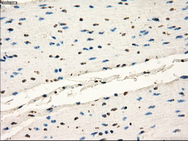 FRK Antibody - IHC of paraffin-embedded colon tissue using anti-FRK mouse monoclonal antibody. (Dilution 1:50).
