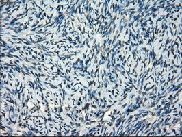 FRK Antibody - IHC of paraffin-embedded Ovary tissue using anti-FRK mouse monoclonal antibody. (Dilution 1:50).