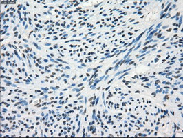 FRK Antibody - IHC of paraffin-embedded endometrium tissue using anti-FRK mouse monoclonal antibody. (Dilution 1:50).