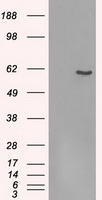 FRK Antibody - HEK293T cells were transfected with the pCMV6-ENTRY control (Left lane) or pCMV6-ENTRY FRK (Right lane) cDNA for 48 hrs and lysed. Equivalent amounts of cell lysates (5 ug per lane) were separated by SDS-PAGE and immunoblotted with anti-FRK.