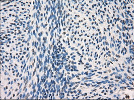 FRK Antibody - IHC of paraffin-embedded endometrium tissue using anti-FRK mouse monoclonal antibody. (Dilution 1:50).