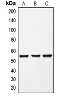 FRK Antibody - Western blot analysis of FRK expression in K562 (A); Molt4 (B); PC12 (C) whole cell lysates.