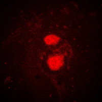 FRK Antibody - Immunofluorescent analysis of FRK staining in K562 cells. Formalin-fixed cells were permeabilized with 0.1% Triton X-100 in TBS for 5-10 minutes and blocked with 3% BSA-PBS for 30 minutes at room temperature. Cells were probed with the primary antibody in 3% BSA-PBS and incubated overnight at 4 C in a humidified chamber. Cells were washed with PBST and incubated with a DyLight 594-conjugated secondary antibody (red) in PBS at room temperature in the dark. DAPI was used to stain the cell nuclei (blue).