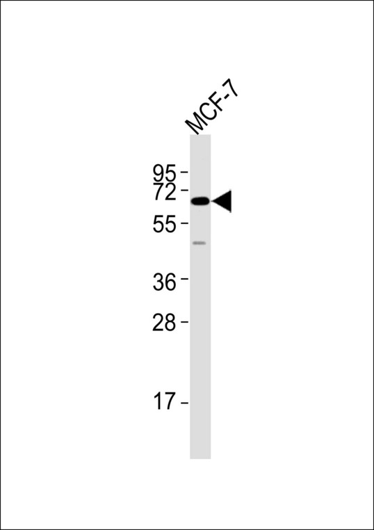 FRK Antibody - Anti-FRK Antibody at 1:1000 dilution + MCF-7 whole cell lysates Lysates/proteins at 20 ug per lane. Secondary Goat Anti-Rabbit IgG, (H+L),Peroxidase conjugated at 1/10000 dilution Predicted band size : 58 kDa Blocking/Dilution buffer: 5% NFDM/TBST.