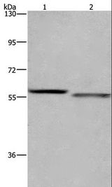 FRK Antibody - Western blot analysis of K562 and A431 cell, using FRK Polyclonal Antibody at dilution of 1:1200.