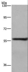 FRK Antibody - Western blot analysis of A431 cell, using FRK Polyclonal Antibody at dilution of 1:1000.