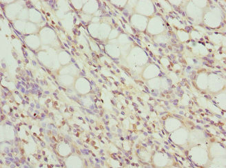 FRK Antibody - Immunohistochemistry of paraffin-embedded human rectum tissue at dilution 1:100